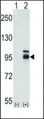 Monoclonal Anti-FGFR4 antibody produced in mouse IgG fraction of antiserum, buffered aqueous solution