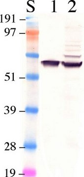 Anti-Retinal Pigment Epithelium 65 Antibody clone 401.8B11.3D9, Chemicon&#174;, from mouse