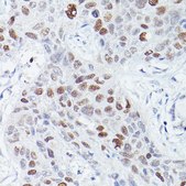 Anti-RBPJK antibody produced in rabbit