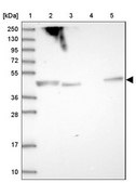 Anti-SHARPIN antibody produced in rabbit Prestige Antibodies&#174; Powered by Atlas Antibodies, affinity isolated antibody, buffered aqueous glycerol solution