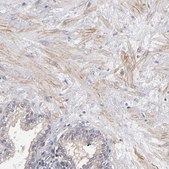 Anti-DMD antibody produced in rabbit Prestige Antibodies&#174; Powered by Atlas Antibodies, affinity isolated antibody, buffered aqueous glycerol solution