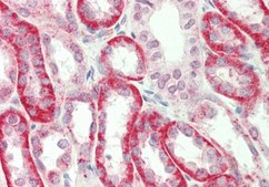 Anti-SV2A antibody produced in rabbit affinity isolated antibody