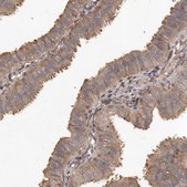 Anti-SLC22A3 antibody produced in rabbit Prestige Antibodies&#174; Powered by Atlas Antibodies, affinity isolated antibody, buffered aqueous glycerol solution