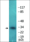 Anti-phospho-CDK1/CDC2 (pThr14) antibody produced in rabbit affinity isolated antibody