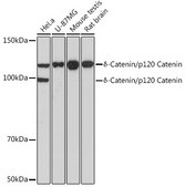 Anti-&#948;-Catenin/p120 Catenin Antibody, clone 5N7Z0, Rabbit Monoclonal