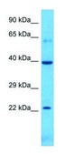 Anti-CASP10 (C-terminal) antibody produced in rabbit affinity isolated antibody