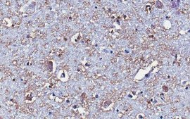 Anti-Prodynorphin (Dynorphin B29) Antibody, clone Dyn9 clone Dyn9, from mouse