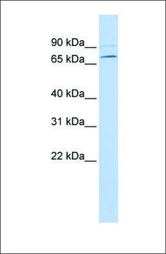Anti-YTHDF3 (ab1) antibody produced in rabbit affinity isolated antibody