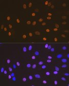 Anti-SOX10 Antibody, clone 3Y3P1, Rabbit Monoclonal