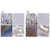 Anti-PCNA antibody produced in rabbit Prestige Antibodies&#174; Powered by Atlas Antibodies, affinity isolated antibody, buffered aqueous glycerol solution, ab1