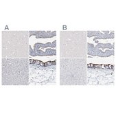 Anti-DNAH5 antibody produced in rabbit Prestige Antibodies&#174; Powered by Atlas Antibodies, affinity isolated antibody, buffered aqueous glycerol solution