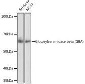 Anti-Glucosylceramidase beta (GBA) antibody produced in rabbit