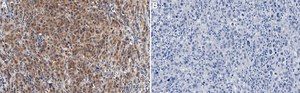 Anti-PTEN Antibody, clone 6H2.1 ZooMAb&#174; Mouse Monoclonal recombinant, expressed in HEK 293 cells