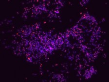 Porphyromonas gingivalis FISH probe - Cy3 Probe for fluorescence in situ hybridization (FISH),20 &#956;M in water