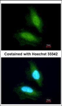 Anti-NPEPPS antibody produced in rabbit affinity isolated antibody, buffered aqueous solution