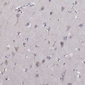 Anti-AKR1B1 antibody produced in rabbit Prestige Antibodies® Powered by Atlas Antibodies, affinity isolated antibody, buffered aqueous glycerol solution