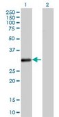 Monoclonal Anti-VDAC2 antibody produced in mouse clone 3D2, purified immunoglobulin, buffered aqueous solution