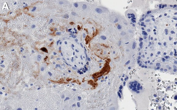 Anti-TBKBP1 Antibody, clone 3F13 ZooMAb&#174; Rabbit Monoclonal recombinant, expressed in HEK 293 cells