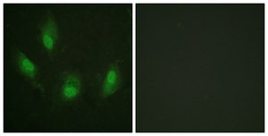 Anti-p53, antibody produced in rabbit affinity isolated antibody