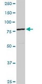 Anti-CUL4A antibody produced in rabbit purified immunoglobulin, buffered aqueous solution
