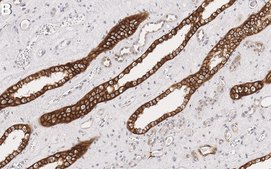 Anti-Raf-1 Antibody, clone 1I3 ZooMAb&#174; Rabbit Monoclonal recombinant, expressed in HEK 293 cells