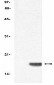 ChIPAb+ Acetyl-Histone H3 - ChIP Validated Antibody and Primer Set from rabbit