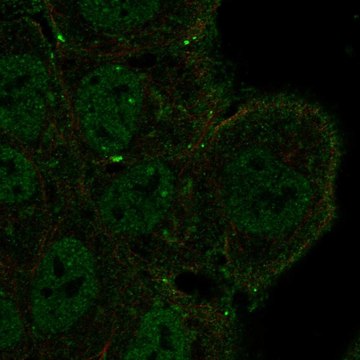 Anti-Notch3 Antibody Produced In Rabbit Prestige Antibodies&#174; Powered by Atlas Antibodies, affinity isolated antibody, buffered aqueous glycerol solution