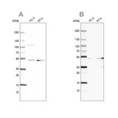 Anti-UQCRC1 antibody produced in rabbit Ab2, Prestige Antibodies&#174; Powered by Atlas Antibodies, affinity isolated antibody, buffered aqueous glycerol solution