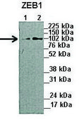 Anti-ZEB1 (N-terminal) antibody produced in rabbit affinity isolated antibody