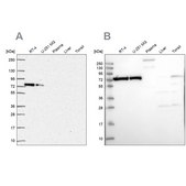 Anti-XRCC6 antibody produced in rabbit Prestige Antibodies&#174; Powered by Atlas Antibodies, affinity isolated antibody, buffered aqueous glycerol solution