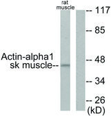 Anti-ACTIN-α-1 antibody produced in rabbit affinity isolated antibody