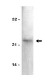 Anti-p21/WAF1/Cip1 Antibody Upstate&#174;, from mouse