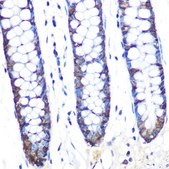 Anti-JAB1/CSN5/COPS5 antibody produced in rabbit