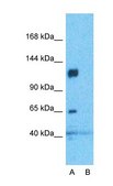 Anti-CACNA2D1 antibody produced in rabbit affinity isolated antibody