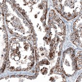 Anti-CLDN3 antibody produced in mouse Prestige Antibodies&#174; Powered by Atlas Antibodies, clone CL13130, purified by using Protein A, buffered aqueous glycerol solution