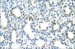 Anti-PRMT5 antibody produced in rabbit IgG fraction of antiserum