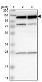 Anti-RBM5 antibody produced in rabbit Prestige Antibodies&#174; Powered by Atlas Antibodies, affinity isolated antibody, buffered aqueous glycerol solution