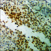 Anti-phospho-BTK (pTyr223) antibody produced in rabbit affinity isolated antibody