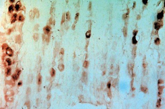 Anti-GFR &#945;3 Antibody serum, Chemicon&#174;