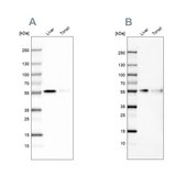 Anti-CD14 antibody produced in rabbit Ab3, Prestige Antibodies&#174; Powered by Atlas Antibodies, affinity isolated antibody, buffered aqueous glycerol solution