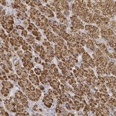 Anti-CYP11A1 antibody produced in rabbit Prestige Antibodies&#174; Powered by Atlas Antibodies, affinity isolated antibody, buffered aqueous glycerol solution