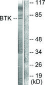 Anti-BTK antibody produced in rabbit affinity isolated antibody