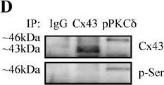 Anti-Phosphoserine antibody, Mouse Monoclonal clone PSR-45, purified from hybridoma cell culture