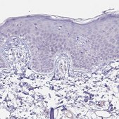 Anti-PYGM antibody produced in rabbit Prestige Antibodies&#174; Powered by Atlas Antibodies, affinity isolated antibody, buffered aqueous glycerol solution