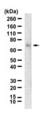 Anti-TYRP1 Antibody, clone 3L4 ZooMAb&#174; Rabbit Monoclonal recombinant, expressed in HEK 293 cells