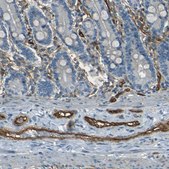 Anti-ENTPD1 antibody produced in rabbit Prestige Antibodies&#174; Powered by Atlas Antibodies, affinity isolated antibody, buffered aqueous glycerol solution