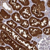 Anti-DDC antibody produced in rabbit Prestige Antibodies&#174; Powered by Atlas Antibodies, affinity isolated antibody, buffered aqueous glycerol solution