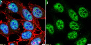Anti-CDKL5 Antibody, clone 2J15 ZooMAb&#174; Rabbit Monoclonal recombinant, expressed in HEK 293 cells
