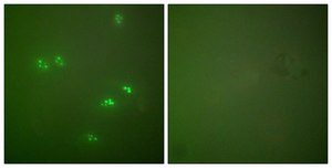 Anti-p14 ARF antibody produced in rabbit affinity isolated antibody