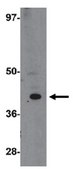 Anti-TRESK Antibody from rabbit, purified by affinity chromatography